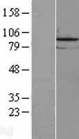 Western blot validation of overexpression lysate (Cat# LY403099) using anti-DDK antibody (Cat# TA50011-100). Left: Cell lysates from un-transfected HEK293T cells; Right: Cell lysates from HEK293T cells transfected with RC203583 using transfection reagent MegaTran 2.0 (Cat# TT210002).