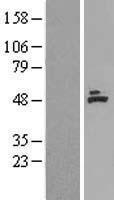 Western blot validation of overexpression lysate (Cat# LY400001) using anti-DDK antibody (Cat# TA50011-100). Left: Cell lysates from un-transfected HEK293T cells; Right: Cell lysates from HEK293T cells transfected with RC202798 using transfection reagent MegaTran 2.0 (Cat# TT210002).