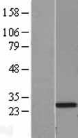 Western blot validation of overexpression lysate (Cat# LY400617) using anti-DDK antibody (Cat# TA50011-100). Left: Cell lysates from un-transfected HEK293T cells; Right: Cell lysates from HEK293T cells transfected with RC202802 using transfection reagent MegaTran 2.0 (Cat# TT210002).