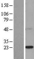 Western blot validation of overexpression lysate (Cat# LY402499) using anti-DDK antibody (Cat# TA50011-100). Left: Cell lysates from un-transfected HEK293T cells; Right: Cell lysates from HEK293T cells transfected with RC200011 using transfection reagent MegaTran 2.0 (Cat# TT210002).