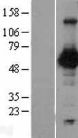 Western blot validation of overexpression lysate (Cat# LY419084) using anti-DDK antibody (Cat# TA50011-100). Left: Cell lysates from un-transfected HEK293T cells; Right: Cell lysates from HEK293T cells transfected with RC200286 using transfection reagent MegaTran 2.0 (Cat# TT210002).