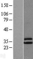Western blot validation of overexpression lysate (Cat# LY416925) using anti-DDK antibody (Cat# TA50011-100). Left: Cell lysates from un-transfected HEK293T cells; Right: Cell lysates from HEK293T cells transfected with RC200301 using transfection reagent MegaTran 2.0 (Cat# TT210002).