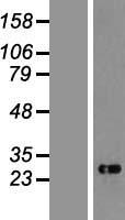 Western blot validation of overexpression lysate (Cat# LY411345) using anti-DDK antibody (Cat# TA50011-100). Left: Cell lysates from un-transfected HEK293T cells; Right: Cell lysates from HEK293T cells transfected with RC200912 using transfection reagent MegaTran 2.0 (Cat# TT210002).