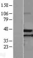 Western blot validation of overexpression lysate (Cat# LY401843) using anti-DDK antibody (Cat# TA50011-100). Left: Cell lysates from un-transfected HEK293T cells; Right: Cell lysates from HEK293T cells transfected with RC201096 using transfection reagent MegaTran 2.0 (Cat# TT210002).