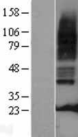 Western blot validation of overexpression lysate (Cat# LY403726) using anti-DDK antibody (Cat# TA50011-100). Left: Cell lysates from un-transfected HEK293T cells; Right: Cell lysates from HEK293T cells transfected with RC221882 using transfection reagent MegaTran 2.0 (Cat# TT210002).