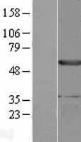 Western blot validation of overexpression lysate (Cat# LY427767) using anti-DDK antibody (Cat# TA50011-100). Left: Cell lysates from un-transfected HEK293T cells; Right: Cell lysates from HEK293T cells transfected with RC227627 using transfection reagent MegaTran 2.0 (Cat# TT210002).
