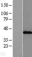 Western blot validation of overexpression lysate (Cat# LY417006) using anti-DDK antibody (Cat# TA50011-100). Left: Cell lysates from un-transfected HEK293T cells; Right: Cell lysates from HEK293T cells transfected with RC201821 using transfection reagent MegaTran 2.0 (Cat# TT210002).
