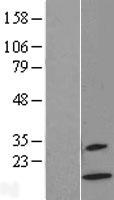 Western blot validation of overexpression lysate (Cat# LY418864) using anti-DDK antibody (Cat# TA50011-100). Left: Cell lysates from un-transfected HEK293T cells; Right: Cell lysates from HEK293T cells transfected with RC210007 using transfection reagent MegaTran 2.0 (Cat# TT210002).