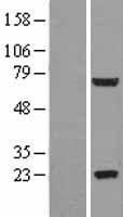 Western blot validation of overexpression lysate (Cat# LY403354) using anti-DDK antibody (Cat# TA50011-100). Left: Cell lysates from un-transfected HEK293T cells; Right: Cell lysates from HEK293T cells transfected with RC202277 using transfection reagent MegaTran 2.0 (Cat# TT210002).