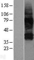 Western blot validation of overexpression lysate (Cat# LY416386) using anti-DDK antibody (Cat# TA50011-100). Left: Cell lysates from un-transfected HEK293T cells; Right: Cell lysates from HEK293T cells transfected with RC206515 using transfection reagent MegaTran 2.0 (Cat# TT210002).