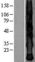 Western blot validation of overexpression lysate (Cat# LY403233) using anti-DDK antibody (Cat# TA50011-100). Left: Cell lysates from un-transfected HEK293T cells; Right: Cell lysates from HEK293T cells transfected with RC215356 using transfection reagent MegaTran 2.0 (Cat# TT210002).