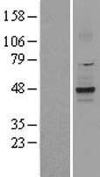 Western blot validation of overexpression lysate (Cat# LY400395) using anti-DDK antibody (Cat# TA50011-100). Left: Cell lysates from un-transfected HEK293T cells; Right: Cell lysates from HEK293T cells transfected with RC214082 using transfection reagent MegaTran 2.0 (Cat# TT210002).