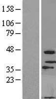 Western blot validation of overexpression lysate (Cat# LY406016) using anti-DDK antibody (Cat# TA50011-100). Left: Cell lysates from un-transfected HEK293T cells; Right: Cell lysates from HEK293T cells transfected with RC215498 using transfection reagent MegaTran 2.0 (Cat# TT210002).