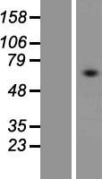 Western blot validation of overexpression lysate (Cat# LY412663) using anti-DDK antibody (Cat# TA50011-100). Left: Cell lysates from un-transfected HEK293T cells; Right: Cell lysates from HEK293T cells transfected with RC223270 using transfection reagent MegaTran 2.0 (Cat# TT210002).