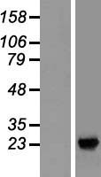 Western blot validation of overexpression lysate (Cat# LY411822) using anti-DDK antibody (Cat# TA50011-100). Left: Cell lysates from un-transfected HEK293T cells; Right: Cell lysates from HEK293T cells transfected with RC213102 using transfection reagent MegaTran 2.0 (Cat# TT210002).