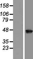 Western blot validation of overexpression lysate (Cat# LY414481) using anti-DDK antibody (Cat# TA50011-100). Left: Cell lysates from un-transfected HEK293T cells; Right: Cell lysates from HEK293T cells transfected with RC219621 using transfection reagent MegaTran 2.0 (Cat# TT210002).