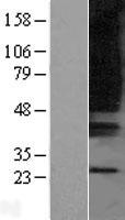 Western blot validation of overexpression lysate (Cat# LY403318) using anti-DDK antibody (Cat# TA50011-100). Left: Cell lysates from un-transfected HEK293T cells; Right: Cell lysates from HEK293T cells transfected with RC221717 using transfection reagent MegaTran 2.0 (Cat# TT210002).