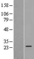 Western blot validation of overexpression lysate (Cat# LY403016) using anti-DDK antibody (Cat# TA50011-100). Left: Cell lysates from un-transfected HEK293T cells; Right: Cell lysates from HEK293T cells transfected with RC216598 using transfection reagent MegaTran 2.0 (Cat# TT210002).