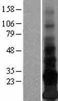 Western blot validation of overexpression lysate (Cat# LY403687) using anti-DDK antibody (Cat# TA50011-100). Left: Cell lysates from un-transfected HEK293T cells; Right: Cell lysates from HEK293T cells transfected with RC223456 using transfection reagent MegaTran 2.0 (Cat# TT210002).