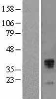 Western blot validation of overexpression lysate (Cat# LY401895) using anti-DDK antibody (Cat# TA50011-100). Left: Cell lysates from un-transfected HEK293T cells; Right: Cell lysates from HEK293T cells transfected with RC219033 using transfection reagent MegaTran 2.0 (Cat# TT210002).