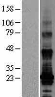 Western blot validation of overexpression lysate (Cat# LY403356) using anti-DDK antibody (Cat# TA50011-100). Left: Cell lysates from un-transfected HEK293T cells; Right: Cell lysates from HEK293T cells transfected with RC222675 using transfection reagent MegaTran 2.0 (Cat# TT210002).