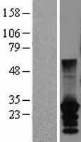 Western blot validation of overexpression lysate (Cat# LY403478) using anti-DDK antibody (Cat# TA50011-100). Left: Cell lysates from un-transfected HEK293T cells; Right: Cell lysates from HEK293T cells transfected with RC220942 using transfection reagent MegaTran 2.0 (Cat# TT210002).