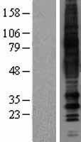 Western blot validation of overexpression lysate (Cat# LY403698) using anti-DDK antibody (Cat# TA50011-100). Left: Cell lysates from un-transfected HEK293T cells; Right: Cell lysates from HEK293T cells transfected with RC224023 using transfection reagent MegaTran 2.0 (Cat# TT210002).