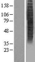 Western blot validation of overexpression lysate (Cat# LY403511) using anti-DDK antibody (Cat# TA50011-100). Left: Cell lysates from un-transfected HEK293T cells; Right: Cell lysates from HEK293T cells transfected with RC215436 using transfection reagent MegaTran 2.0 (Cat# TT210002).