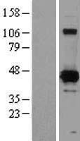Western blot validation of overexpression lysate (Cat# LY402930) using anti-DDK antibody (Cat# TA50011-100). Left: Cell lysates from un-transfected HEK293T cells; Right: Cell lysates from HEK293T cells transfected with RC218029 using transfection reagent MegaTran 2.0 (Cat# TT210002).