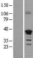 Western blot validation of overexpression lysate (Cat# LY403503) using anti-DDK antibody (Cat# TA50011-100). Left: Cell lysates from un-transfected HEK293T cells; Right: Cell lysates from HEK293T cells transfected with RC208633 using transfection reagent MegaTran 2.0 (Cat# TT210002).