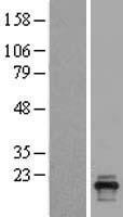 Western blot validation of overexpression lysate (Cat# LY403561) using anti-DDK antibody (Cat# TA50011-100). Left: Cell lysates from un-transfected HEK293T cells; Right: Cell lysates from HEK293T cells transfected with RC208472 using transfection reagent MegaTran 2.0 (Cat# TT210002).