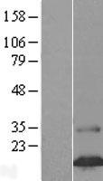Western blot validation of overexpression lysate (Cat# LY403479) using anti-DDK antibody (Cat# TA50011-100). Left: Cell lysates from un-transfected HEK293T cells; Right: Cell lysates from HEK293T cells transfected with RC207710 using transfection reagent MegaTran 2.0 (Cat# TT210002).