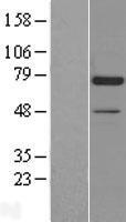 Western blot validation of overexpression lysate (Cat# LY402945) using anti-DDK antibody (Cat# TA50011-100). Left: Cell lysates from un-transfected HEK293T cells; Right: Cell lysates from HEK293T cells transfected with RC203407 using transfection reagent MegaTran 2.0 (Cat# TT210002).