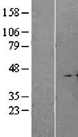 Western blot validation of overexpression lysate (Cat# LY402588) using anti-DDK antibody (Cat# TA50011-100). Left: Cell lysates from un-transfected HEK293T cells; Right: Cell lysates from HEK293T cells transfected with RC202259 using transfection reagent MegaTran 2.0 (Cat# TT210002).