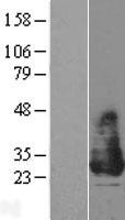Western blot validation of overexpression lysate (Cat# LY403536) using anti-DDK antibody (Cat# TA50011-100). Left: Cell lysates from un-transfected HEK293T cells; Right: Cell lysates from HEK293T cells transfected with RC211320 using transfection reagent MegaTran 2.0 (Cat# TT210002).
