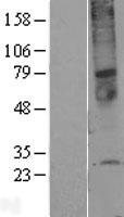 Western blot validation of overexpression lysate (Cat# LY402641) using anti-DDK antibody (Cat# TA50011-100). Left: Cell lysates from un-transfected HEK293T cells; Right: Cell lysates from HEK293T cells transfected with RC204412 using transfection reagent MegaTran 2.0 (Cat# TT210002).