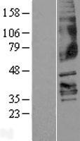 Western blot validation of overexpression lysate (Cat# LY401634) using anti-DDK antibody (Cat# TA50011-100). Left: Cell lysates from un-transfected HEK293T cells; Right: Cell lysates from HEK293T cells transfected with RC207772 using transfection reagent MegaTran 2.0 (Cat# TT210002).