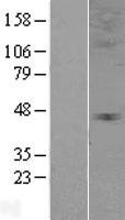 Western blot validation of overexpression lysate (Cat# LY401955) using anti-DDK antibody (Cat# TA50011-100). Left: Cell lysates from un-transfected HEK293T cells; Right: Cell lysates from HEK293T cells transfected with RC206274 using transfection reagent MegaTran 2.0 (Cat# TT210002).