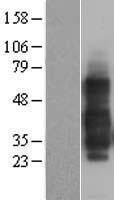 Western blot validation of overexpression lysate (Cat# LY401254) using anti-DDK antibody (Cat# TA50011-100). Left: Cell lysates from un-transfected HEK293T cells; Right: Cell lysates from HEK293T cells transfected with RC201167 using transfection reagent MegaTran 2.0 (Cat# TT210002).