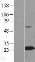 Western blot validation of overexpression lysate (Cat# LY403154) using anti-DDK antibody (Cat# TA50011-100). Left: Cell lysates from un-transfected HEK293T cells; Right: Cell lysates from HEK293T cells transfected with RC202583 using transfection reagent MegaTran 2.0 (Cat# TT210002).