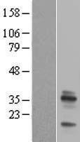 Western blot validation of overexpression lysate (Cat# LY400039) using anti-DDK antibody (Cat# TA50011-100). Left: Cell lysates from un-transfected HEK293T cells; Right: Cell lysates from HEK293T cells transfected with RC200643 using transfection reagent MegaTran 2.0 (Cat# TT210002).