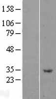 Western blot validation of overexpression lysate (Cat# LY402983) using anti-DDK antibody (Cat# TA50011-100). Left: Cell lysates from un-transfected HEK293T cells; Right: Cell lysates from HEK293T cells transfected with RC201282 using transfection reagent MegaTran 2.0 (Cat# TT210002).