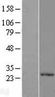 Western blot validation of overexpression lysate (Cat# LY403314) using anti-DDK antibody (Cat# TA50011-100). Left: Cell lysates from un-transfected HEK293T cells; Right: Cell lysates from HEK293T cells transfected with RC201338 using transfection reagent MegaTran 2.0 (Cat# TT210002).