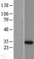 Western blot validation of overexpression lysate (Cat# LY400327) using anti-DDK antibody (Cat# TA50011-100). Left: Cell lysates from un-transfected HEK293T cells; Right: Cell lysates from HEK293T cells transfected with RC200620 using transfection reagent MegaTran 2.0 (Cat# TT210002).