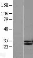 Western blot validation of overexpression lysate (Cat# LY401980) using anti-DDK antibody (Cat# TA50011-100). Left: Cell lysates from un-transfected HEK293T cells; Right: Cell lysates from HEK293T cells transfected with RC202898 using transfection reagent MegaTran 2.0 (Cat# TT210002).