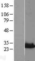 Western blot validation of overexpression lysate (Cat# LY402439) using anti-DDK antibody (Cat# TA50011-100). Left: Cell lysates from un-transfected HEK293T cells; Right: Cell lysates from HEK293T cells transfected with RC203264 using transfection reagent MegaTran 2.0 (Cat# TT210002).