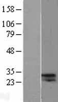 Western blot validation of overexpression lysate (Cat# LY403249) using anti-DDK antibody (Cat# TA50011-100). Left: Cell lysates from un-transfected HEK293T cells; Right: Cell lysates from HEK293T cells transfected with RC202746 using transfection reagent MegaTran 2.0 (Cat# TT210002).