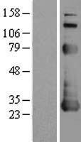 Western blot validation of overexpression lysate (Cat# LY401296) using anti-DDK antibody (Cat# TA50011-100). Left: Cell lysates from un-transfected HEK293T cells; Right: Cell lysates from HEK293T cells transfected with RC200591 using transfection reagent MegaTran 2.0 (Cat# TT210002).
