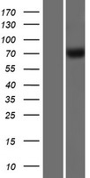 Western blot validation of overexpression lysate (Cat# LY409376) using anti-DDK antibody (Cat# TA50011-100). Left: Cell lysates from un-transfected HEK293T cells; Right: Cell lysates from HEK293T cells transfected with RC209769 using transfection reagent MegaTran 2.0 (Cat# TT210002).