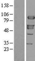 Western blot validation of overexpression lysate (Cat# LY401897) using anti-DDK antibody (Cat# TA50011-100). Left: Cell lysates from un-transfected HEK293T cells; Right: Cell lysates from HEK293T cells transfected with RC204952 using transfection reagent MegaTran 2.0 (Cat# TT210002).